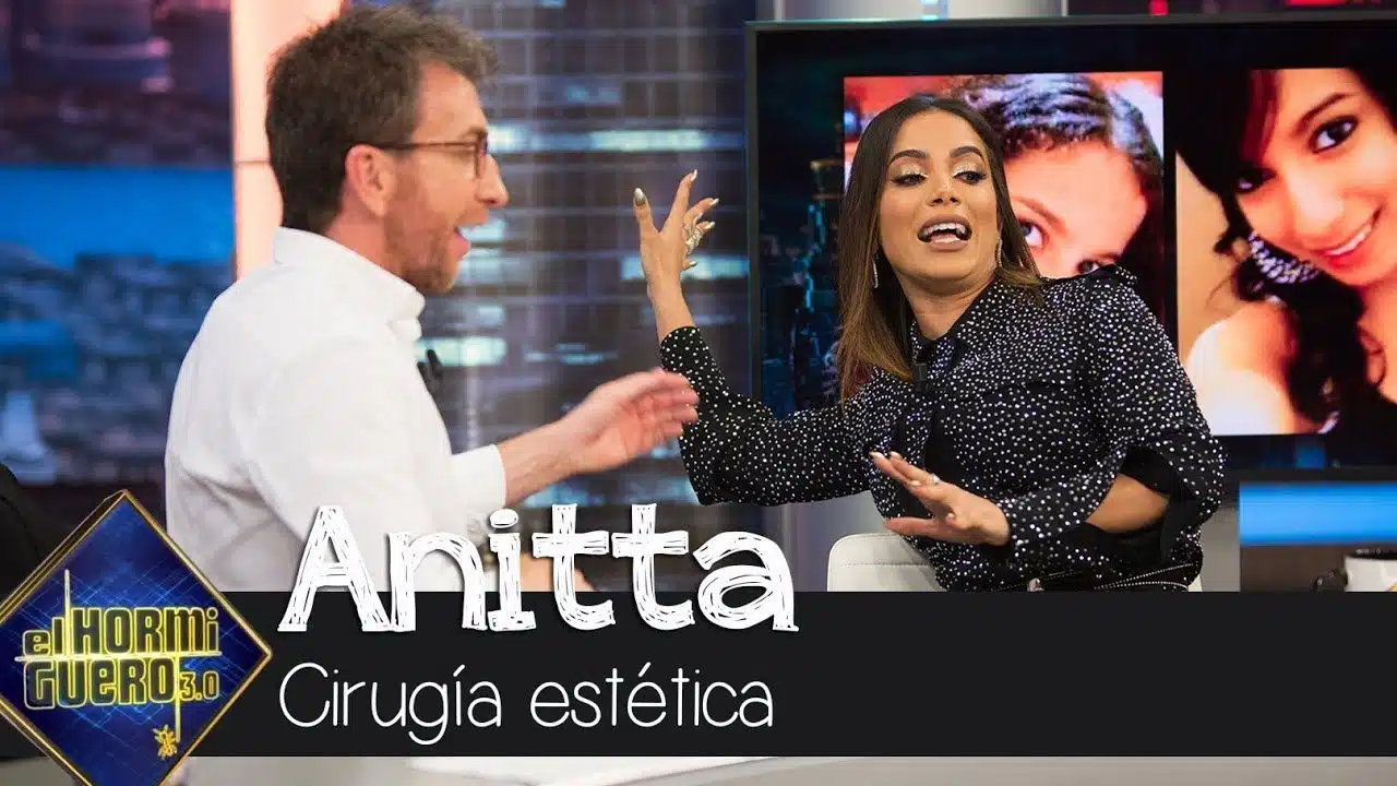 Anitta explica su afición a la cirugía estética: "Yo misma diseñé mi cara" - El Hormiguero 3.0