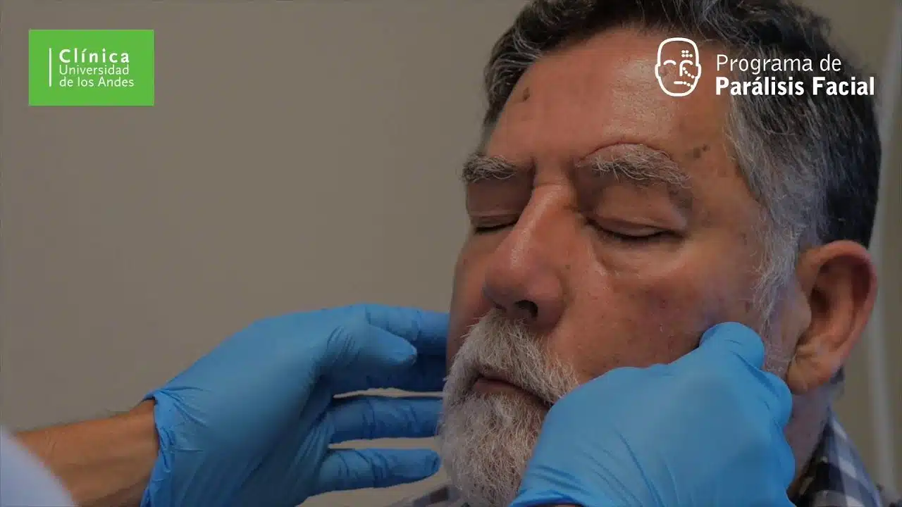 Paciente corrige parálisis facial gracias a cirugía