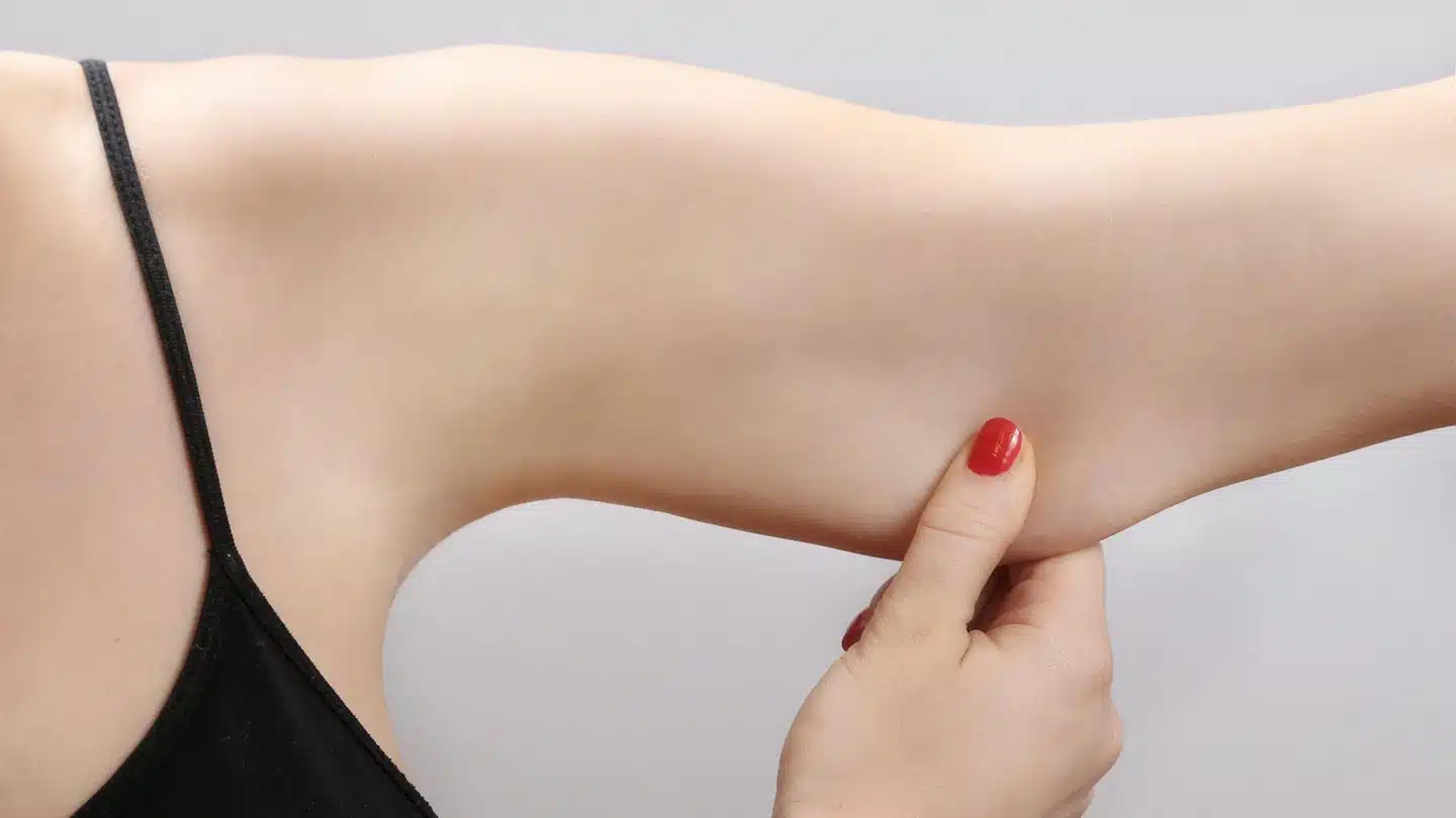 Como usar la elevacion del brazo para mejorar la flacidez