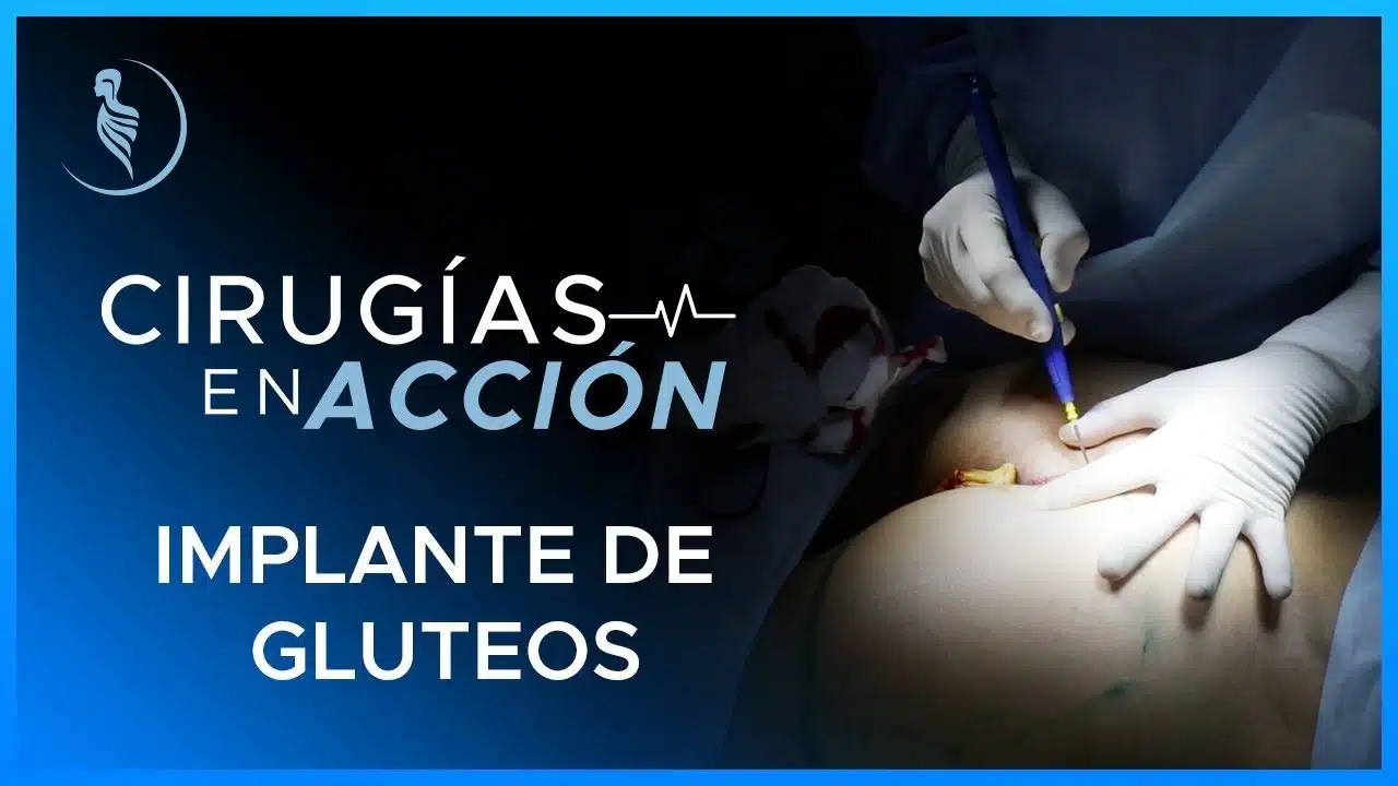 Implante de cadera-Martínez Cirugía Plástica