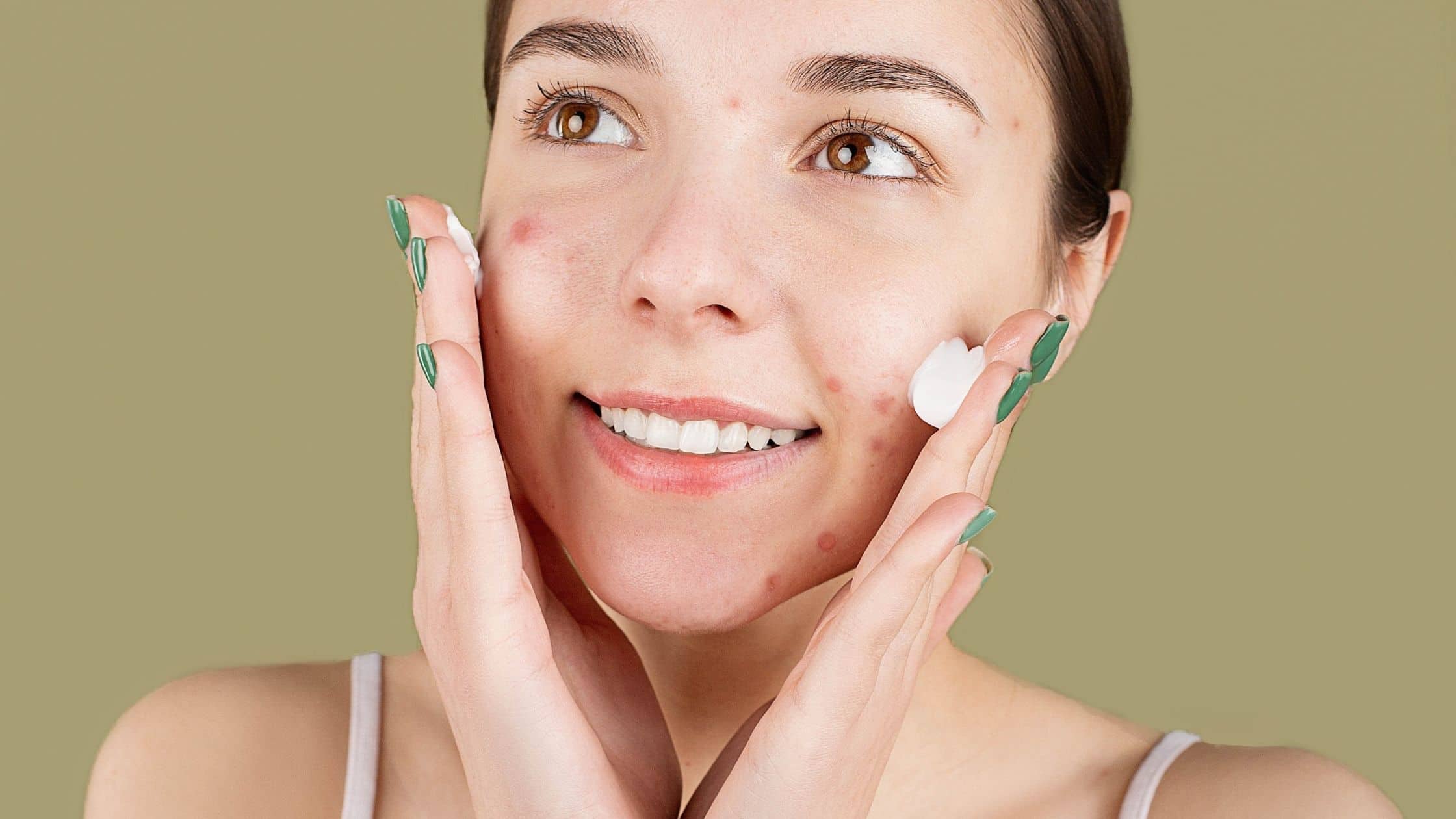¿Funcionan las exfoliaciones quimicas para las cicatrices del acne