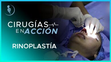 Cirugía Plástica Rinoplastia-Martínez
