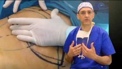 Cirugía plástica abdominal, esta es una cirugía para cambiar el cuerpo.