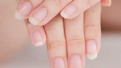 Síntomas, causas y prevención de uñas anormales.