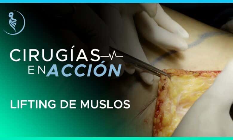 Lifting de Muslos – Cirugía Plástica Martínez