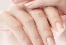 10 cambios en las uñas que su dermatólogo debe revisar