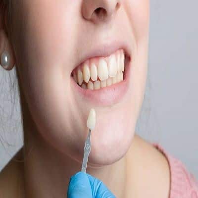 Costos pendientes de tratamiento dental en