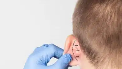 Cirugía estética de orejas en niños y adultos