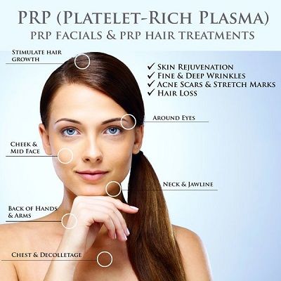 Los 5 principales beneficios del tratamiento PRP