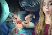 Sorprendente cirugía ortognática | Pensamientos médicos