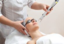 Los 5 mejores tratamientos con láser facial y cómo pueden ayudar