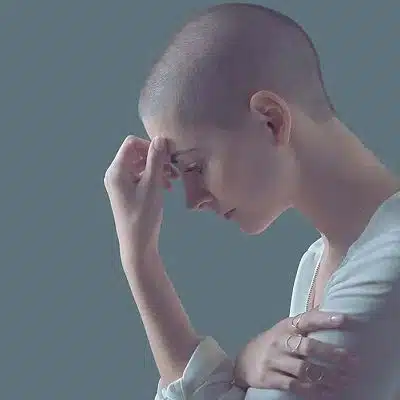 caída del cabello después de la quimioterapia