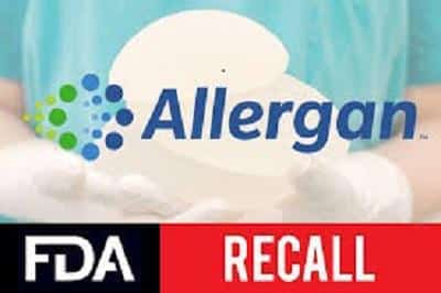 Allergan BIOCELL textured breast implant recall
