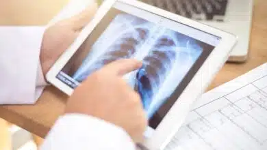 ¿Qué significan los pulmones en medicina?