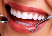 Tratamientos de Estética Dental