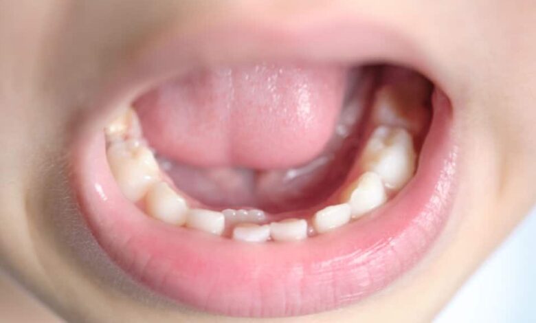 Dientes de tiburón: lo que la naturaleza puede enseñarnos sobre salud dental