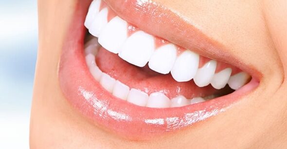 Dentista en el Barrio de Salamanca: Excelencia y Confianza en Cada Sonrisa 3 Carillas dentales sonrisa perfecta