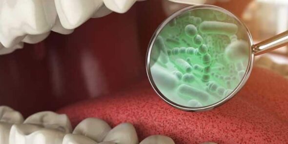 Microbioma Oral y la Salud Sistémica