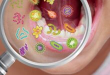 Microbioma Oral y su Influencia en la Salud Sistémica