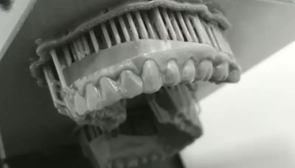 las resinas dentales y la impresión 3D