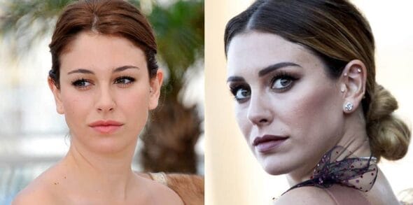 Famosas con medicina estética a las que quieren parecerse las españolas 3 Famosas con medicina estética Blanca Suárez