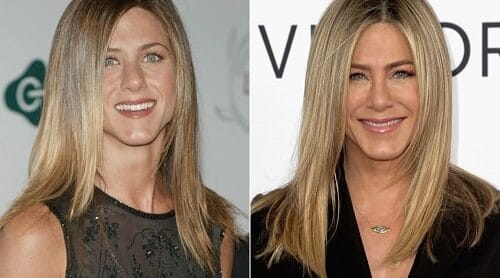 Famosas con medicina estética a las que quieren parecerse las españolas 2 Famosas con medicina estética jennifer anniston