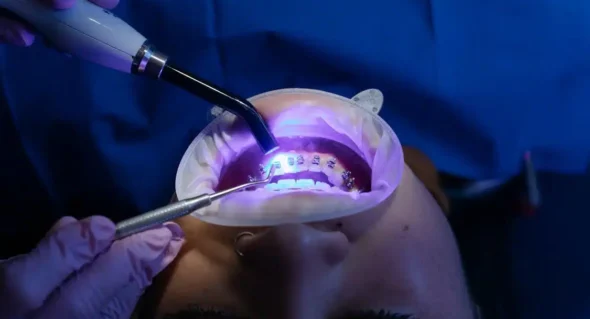 tratamientos dentales Gines y Aljarafe