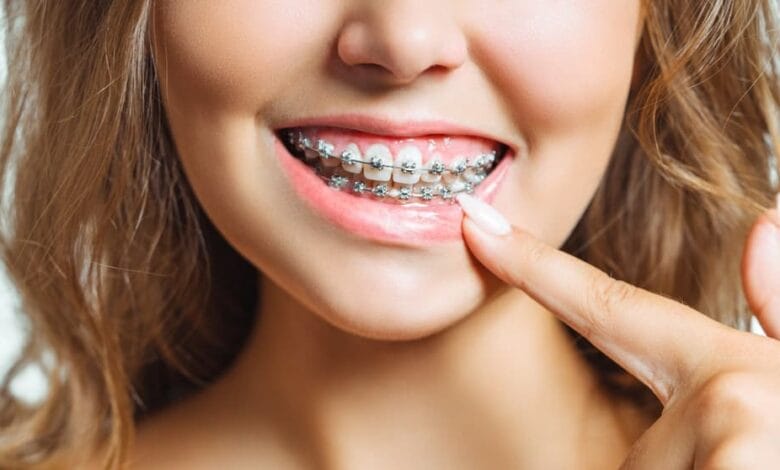 Donde realizarse tratamientos dentales en Gines y Aljarafe