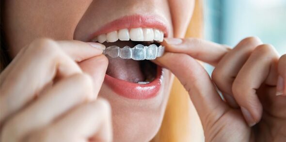 Tratamientos dentales